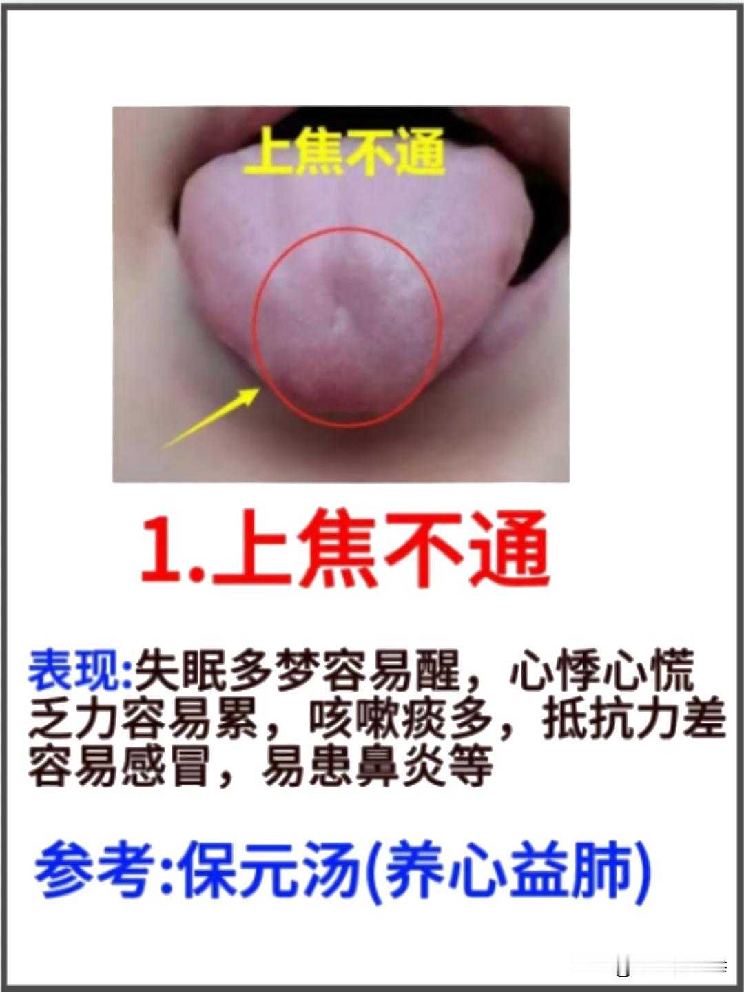 三焦一堵，全身受苦！上焦不通失眠、中焦不通胃炎、下焦不通萎软，中医教你调！
#中