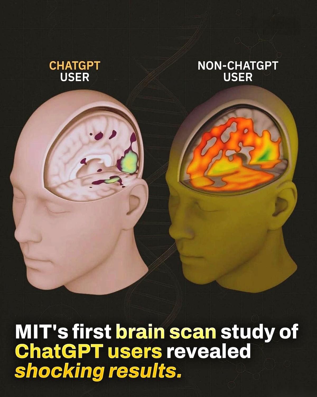 麻省理工学院把一群ChatGPT的重度用户，塞进了脑部扫描仪。
结果出来，监视器