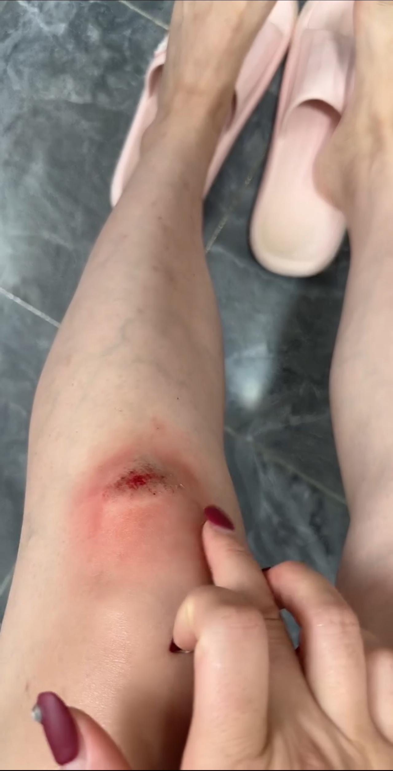 我说，这是我喝酒喝多卡的，你们信吗？

我是@香茗还未凉 记录生活点滴，谢谢有你