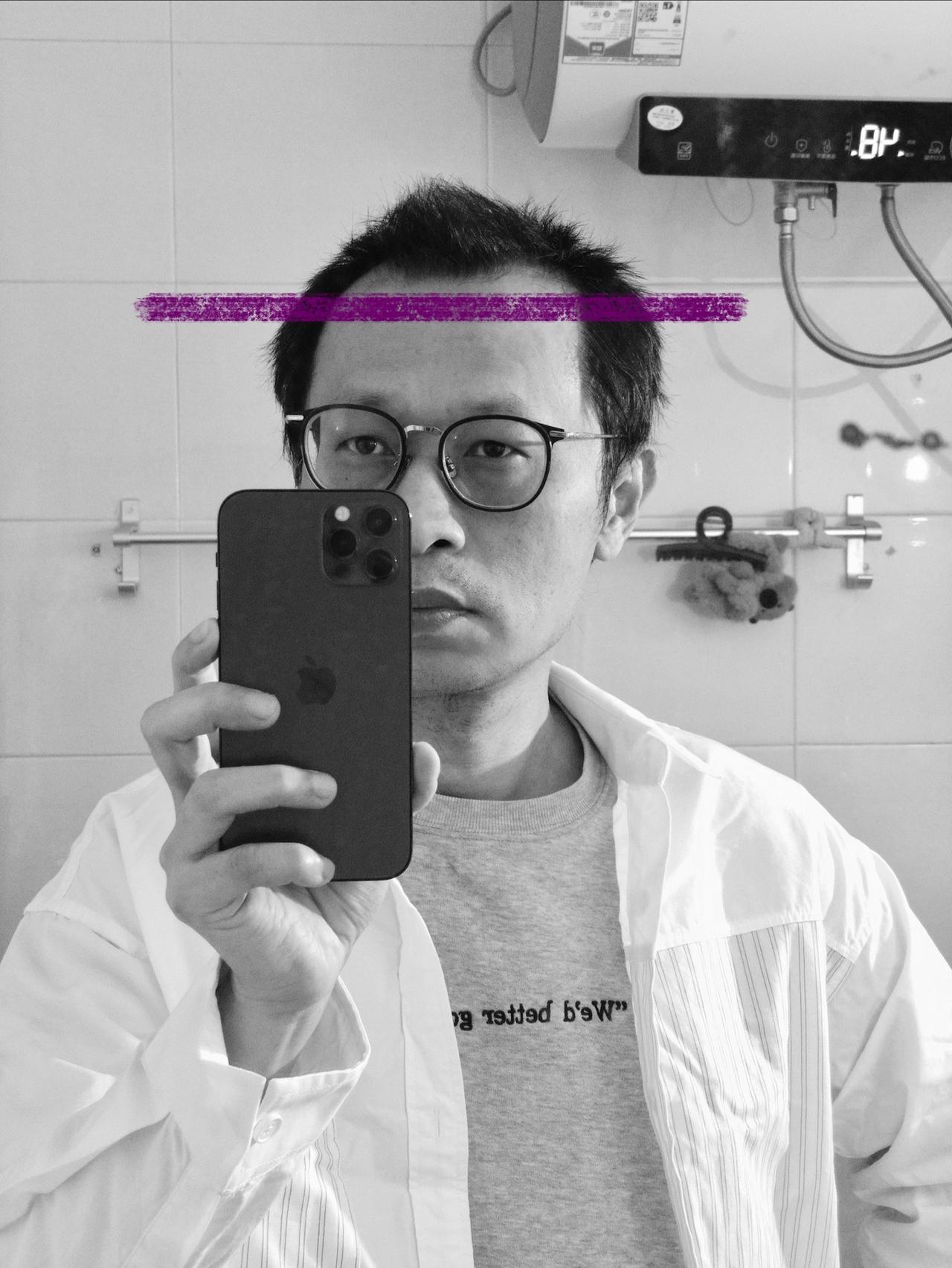 八零的，快五十了，这发际线还有挽救余地吗？