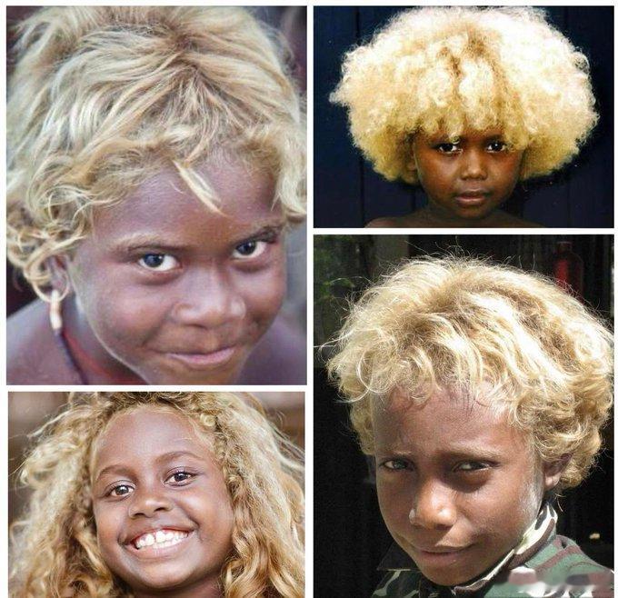 美拉尼西亚的一些朋友，也有天生的金发。金发特征是通过 TYRP1 基因发展而来的