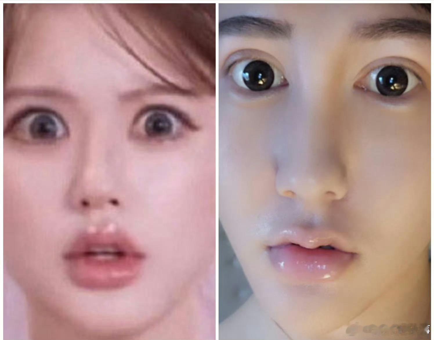 打针需要恢复期吗[疑问][疑问][疑问]另外当人家白去韩国泰国玩的啊，去一趟就注