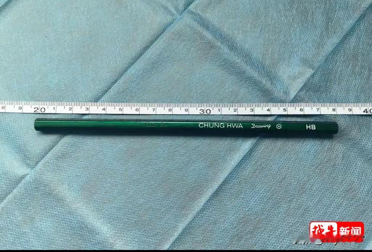 医生都吓了一跳！绍兴12岁男孩体内竟塞进了一支铅笔

近日，一名12岁的男孩小木