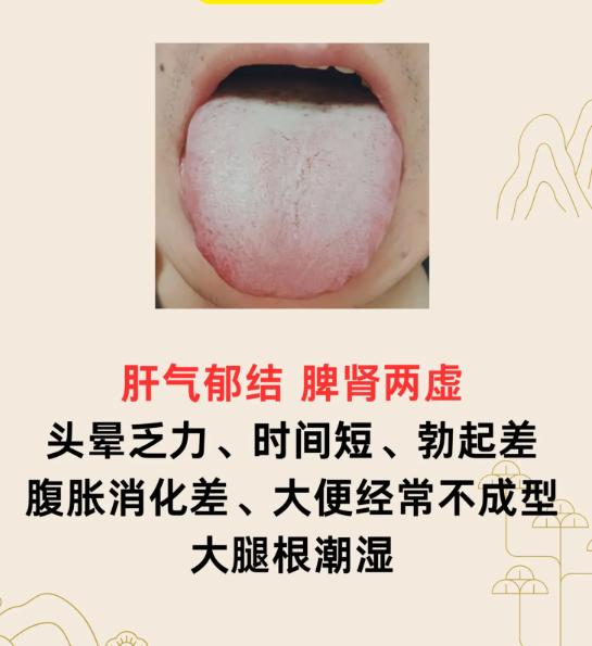 2 种脏腑失调舌象辨证