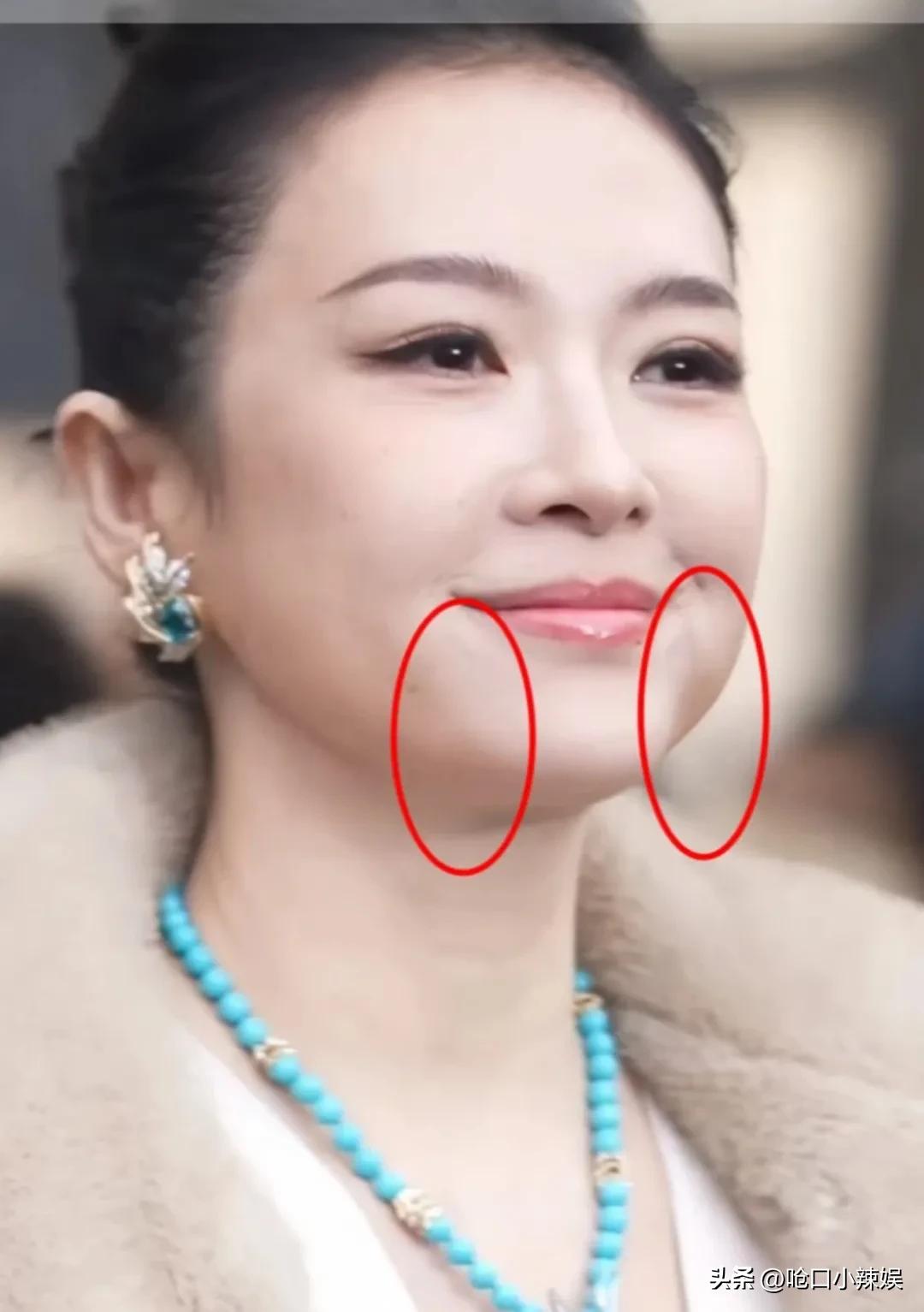 中下面部这样也蛮福相！

章子怡这样挺好看的，像是胖了很多，和蔡明那种苹果肌鼓鼓