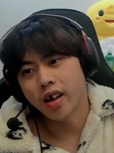 不是Ale你牙呢？啥情况。最近没比赛人也憔悴了。。。无声绕后，全靠牙齿漏风？英雄