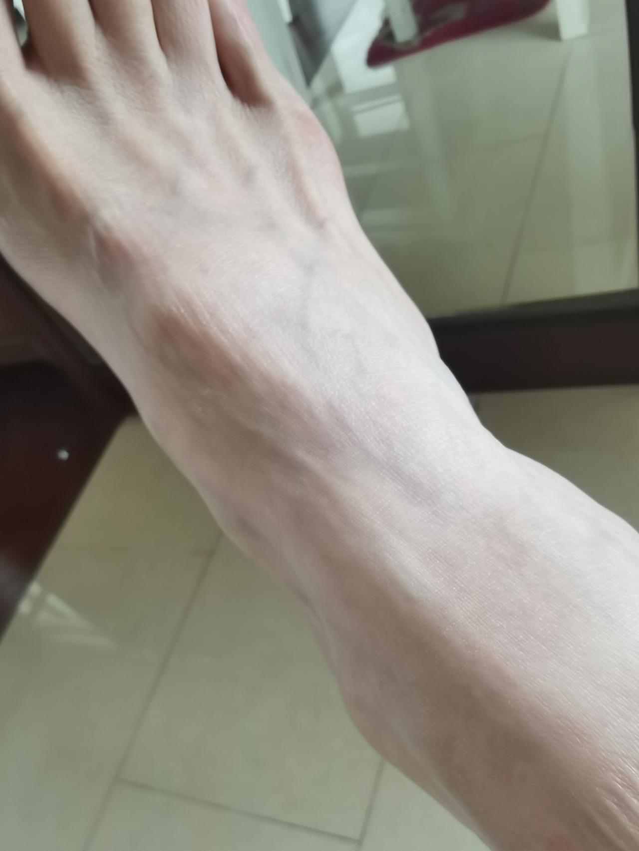 看到大家对我的鼓励和不嫌弃，真的非常感动。谢谢你们。

也有很多朋友关心我的手为