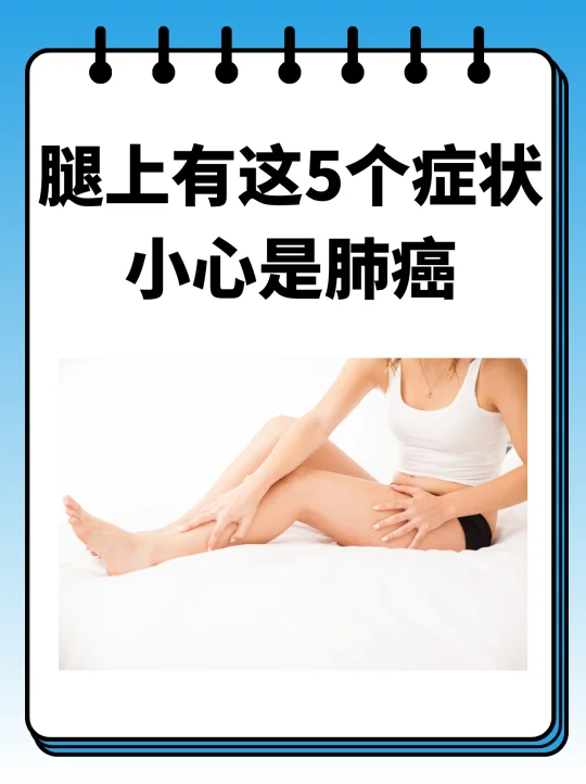 腿上有这5个症状，小心是肺癌