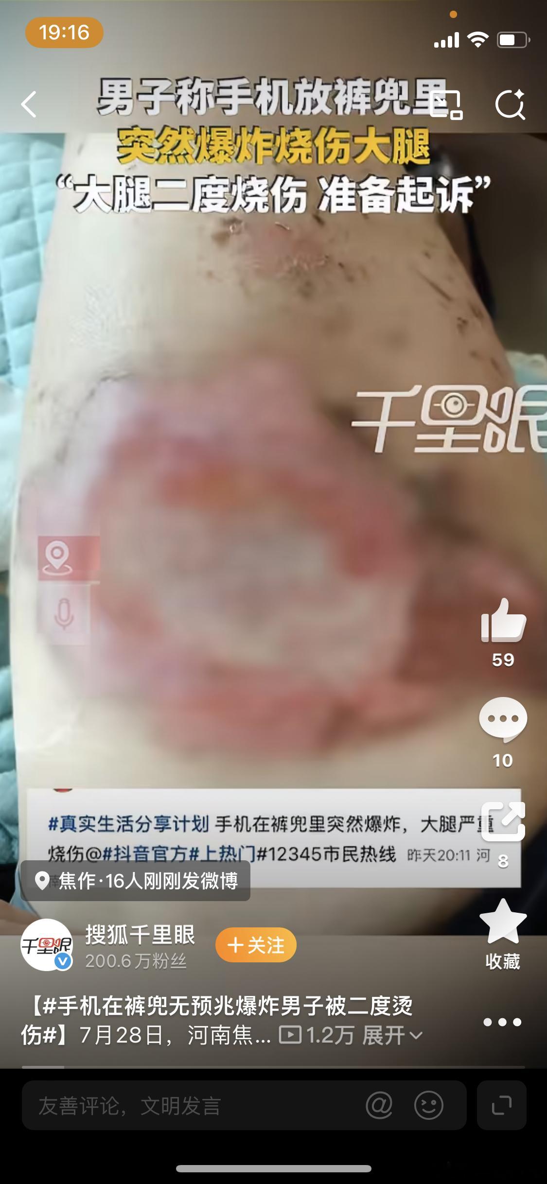 手机在裤兜无预兆爆炸男子被二度烫伤夏天的时候手机真的很烫，老是怀疑自己要被烫伤。