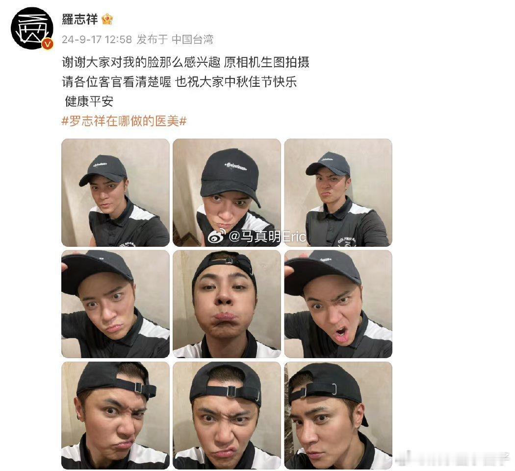 #罗志祥发自拍回应医美争议#罗志祥发自拍回应医美争议：“谢谢大家对我的脸那么感兴