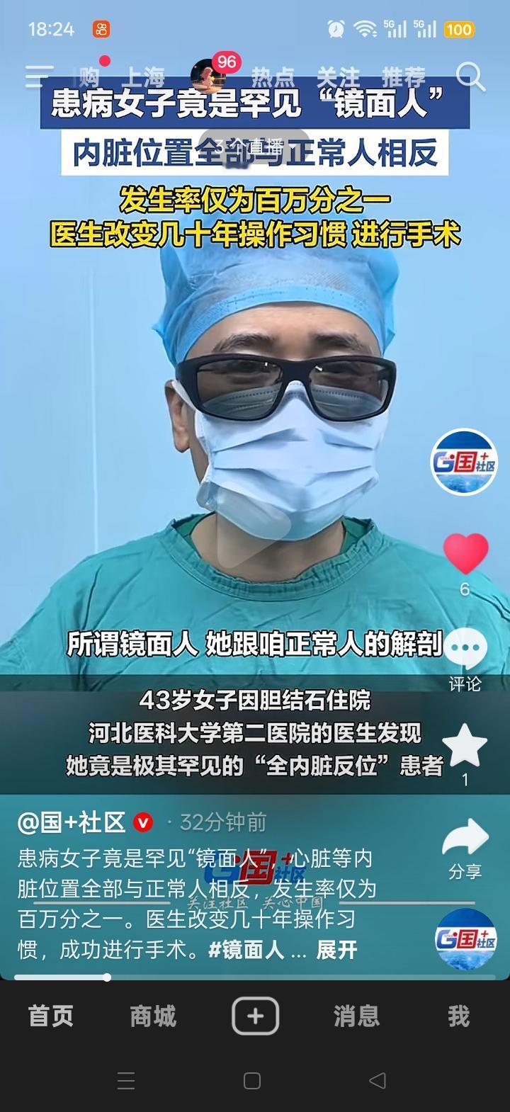 河北有一位 43 岁的患病女子是“镜面人”，这种情况着实神奇。所谓“镜面人”，即