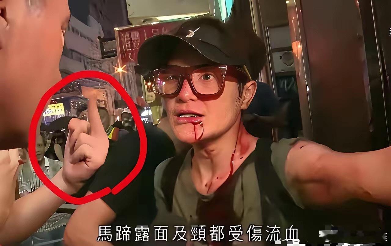 最可怕的是马蹄露做得如此好香港居然无一个港星为她发声和支持TVB甚至与她割席，然