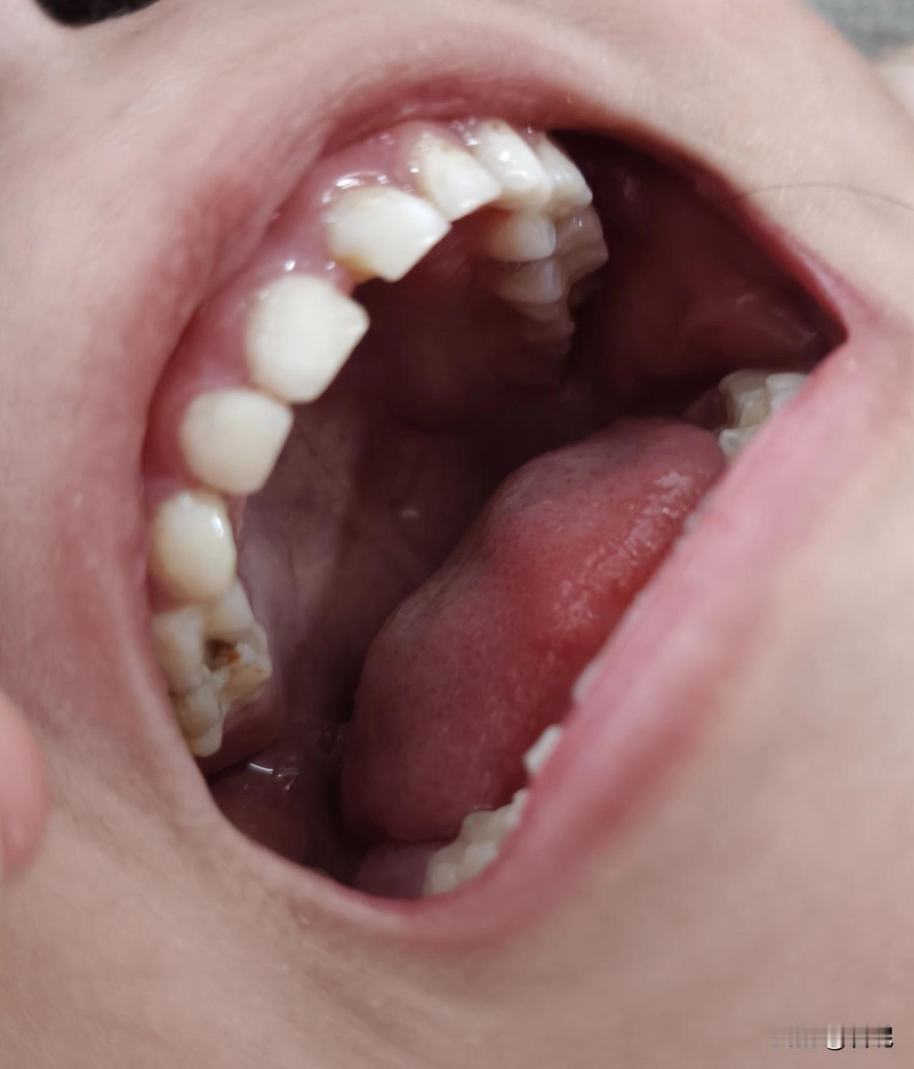我就纳闷了，幼儿园门口每天检查口腔的医生，就不能多一句嘴吗？孩子牙齿出问题，不告