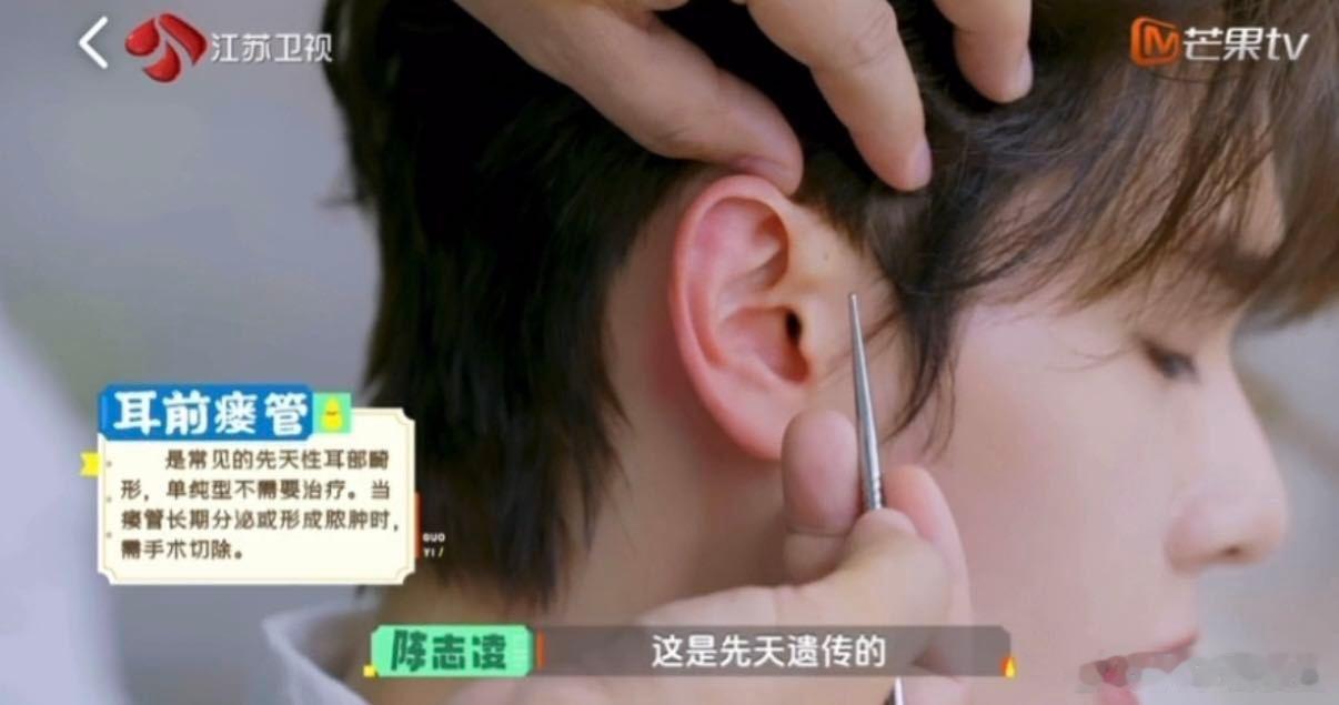 高卿尘先天性耳前瘘管 高卿尘耳前瘘管 跟着《国医少年志》涨知识！高卿尘耳朵上的小