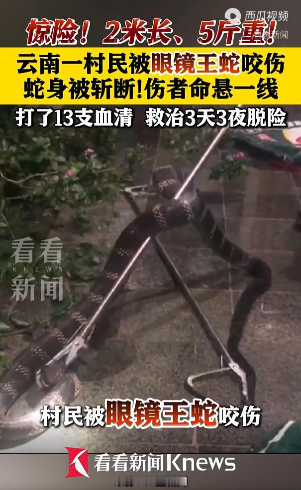 云南昭通，一村民田间劳作时，被一条2米长，5斤重的眼镜王蛇咬伤，生命垂危。医护人