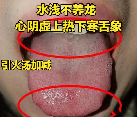 上热下寒，不过是：【水浅不养龙，水寒不藏龙】，这文看懂了，你也就会治了

水浅不