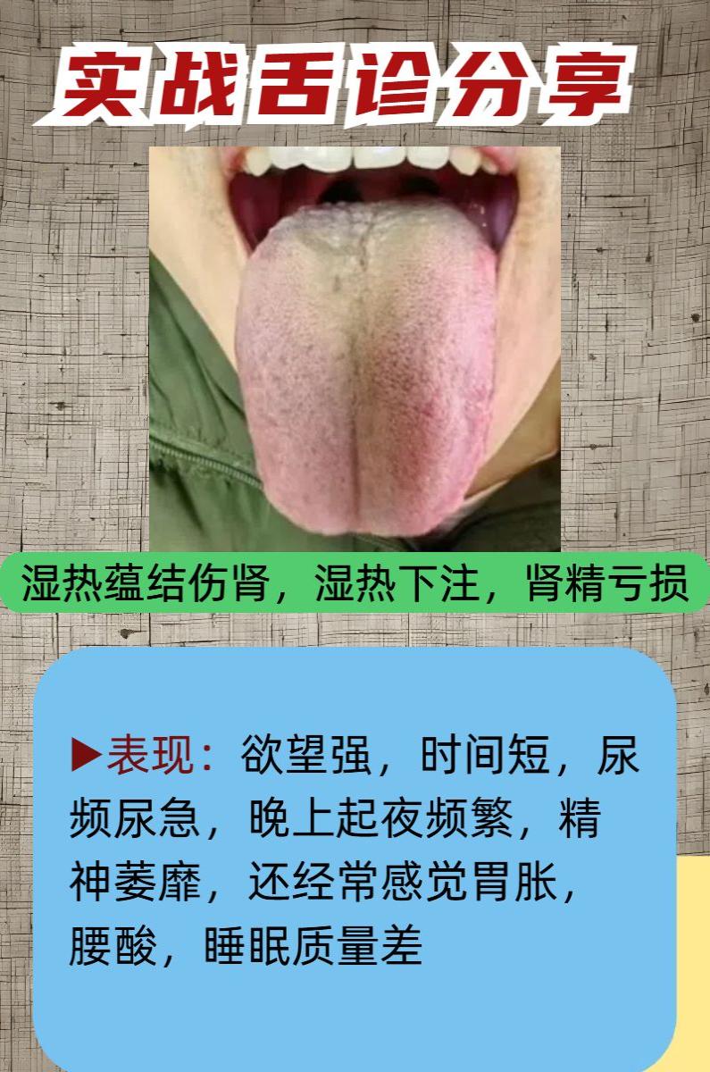今天继续帮大家看舌象，有需要的留下你的舌头照片！

昨天也帮不少朋友辨证分析了舌