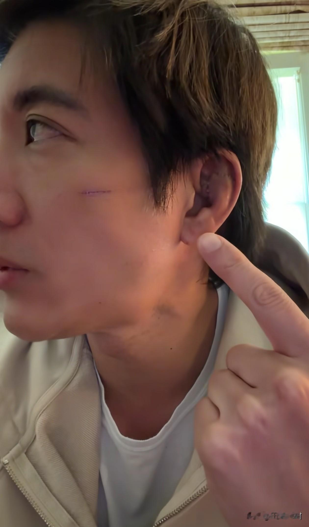 吃一堑，长一智。

王力宏还是怕了，受伤第七天后，向网友报平安的同时，更是传出重