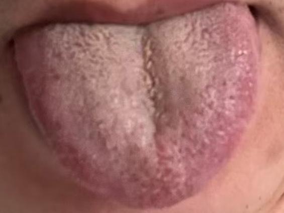 精关固摄能力偏弱该如何调理？科学调养稳步稳固阈值






很多男同志被精关阈