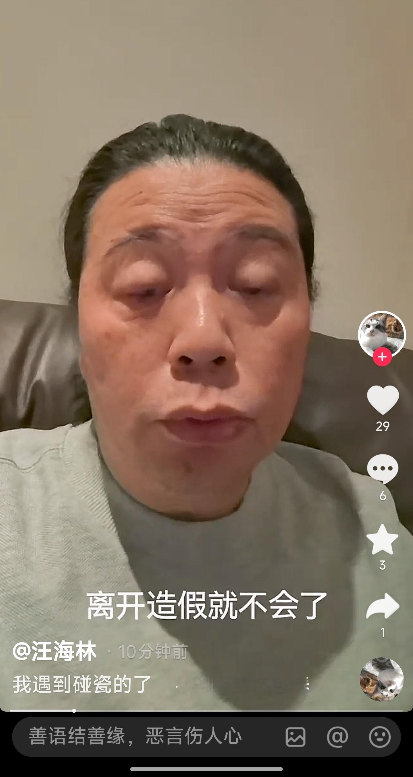 汪海林可能生大病了，甲状腺那些…… ​​​