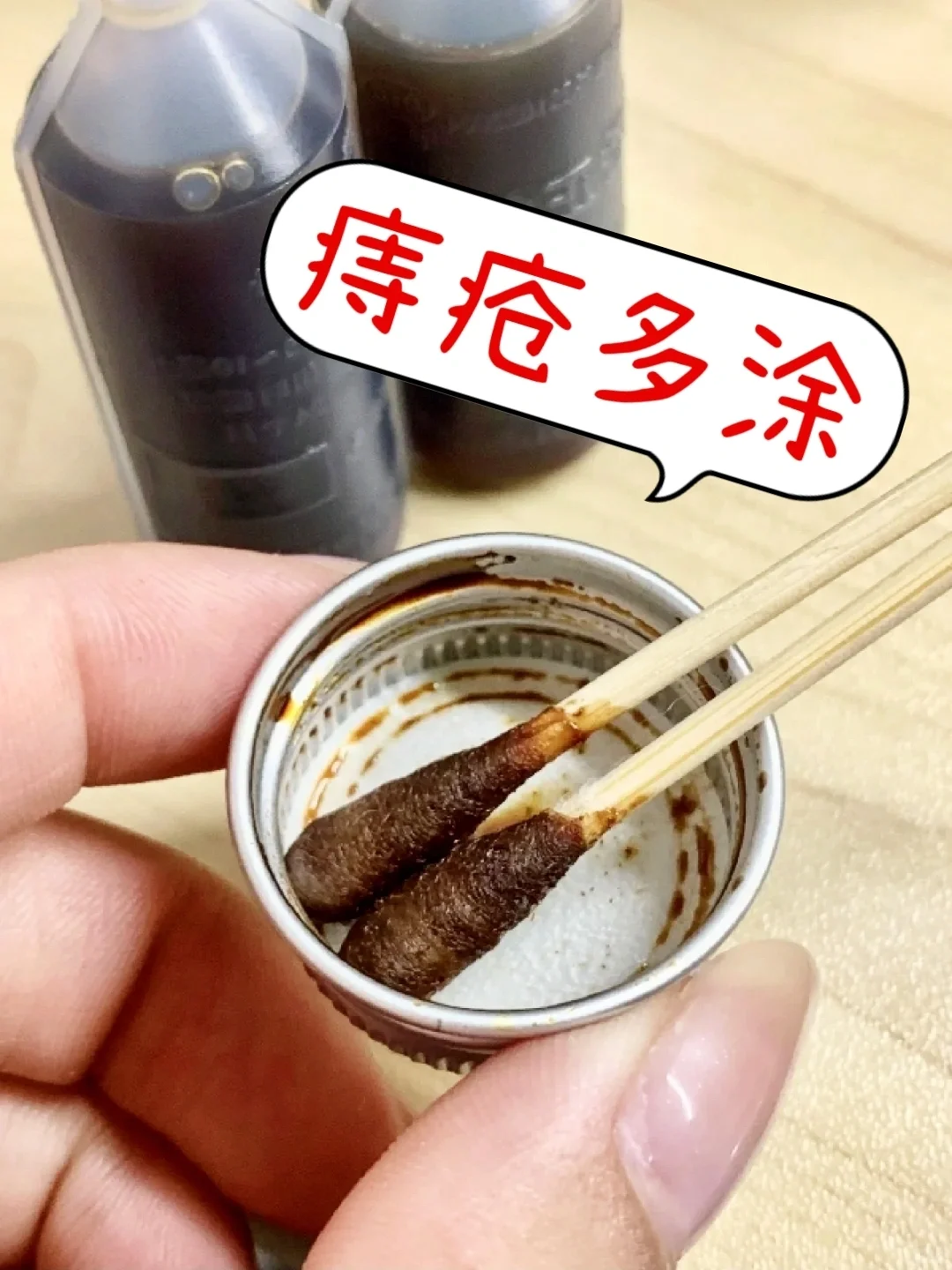 重度痔疮第一次感受到正气水的威力。。。