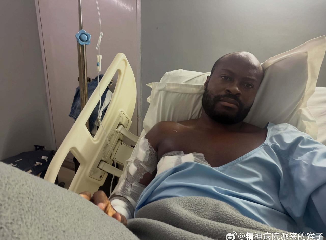 阿鲁纳结束印度终极联赛赛事，在印度进行了多发性脂肪瘤手术🏥早日康复💪🏾 ​