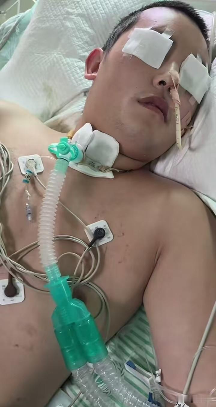 病床上的人插满管路、人事不知，而守在一旁的家属才是扛下所有苦楚的人。一边是呼吸机