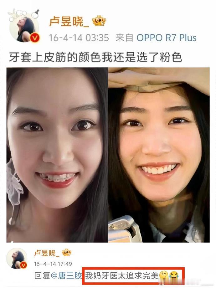 卢昱晓有牙医妈妈，日常护牙挺方便，牙齿问题能及时处理，这或许就是小小的优势吧。 