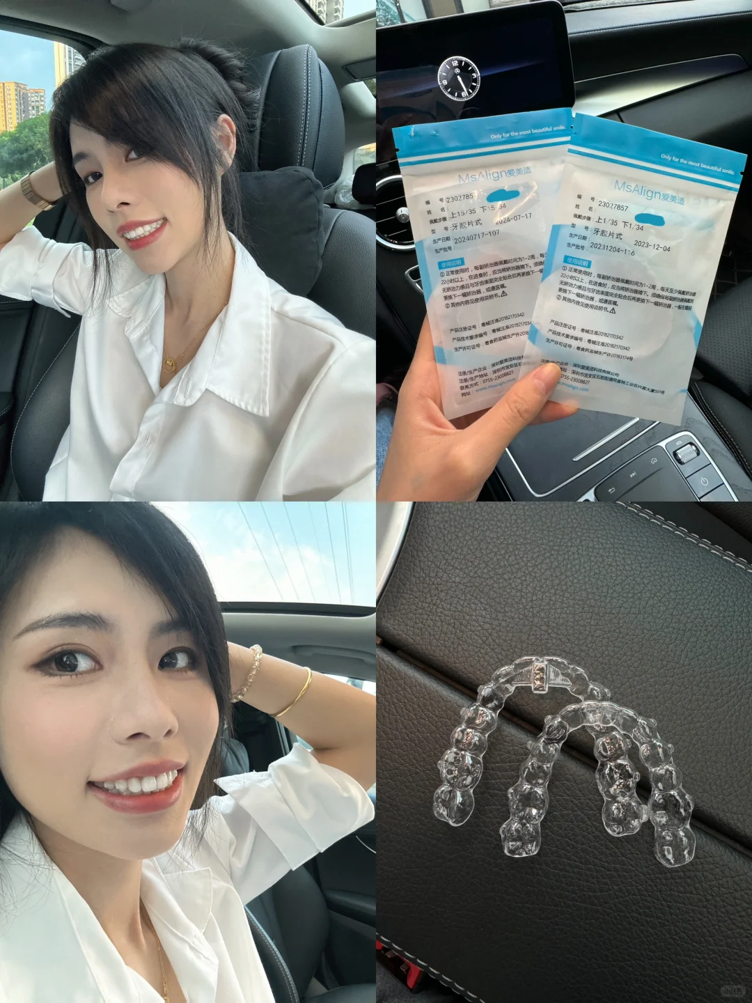 爱美适隐形牙套比我之前的钢牙套好太多了