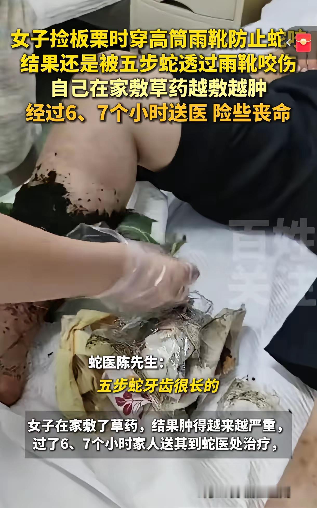 心太大了！浙江温州，一女子穿雨靴上山捡板粟，不小心被蛇咬伤了小腿，随后立即回家用