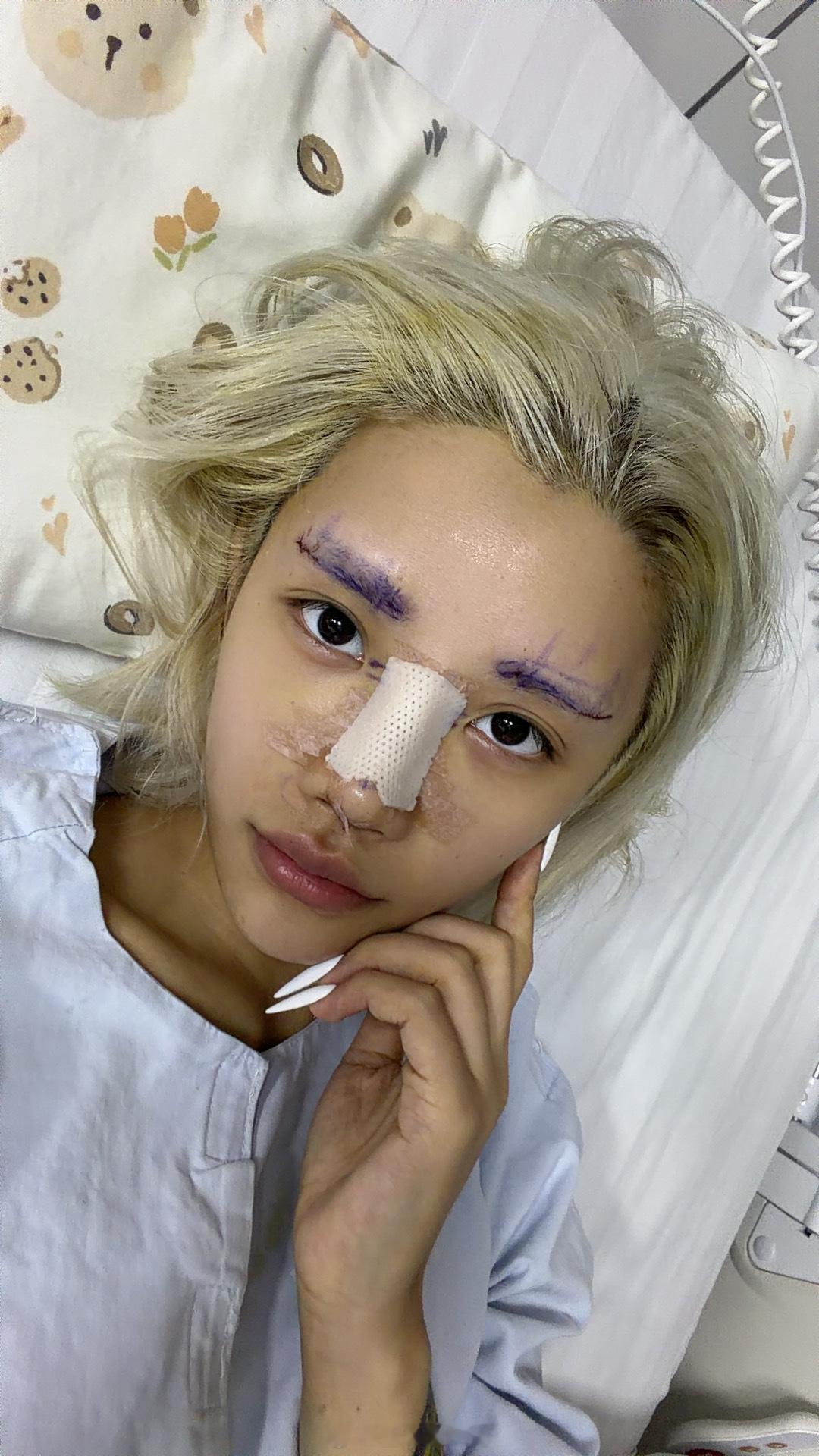 老有人说10个鼻子9个返厂维修其实不是啊 我这个鼻子也可以不去做的 只是我觉得鼻
