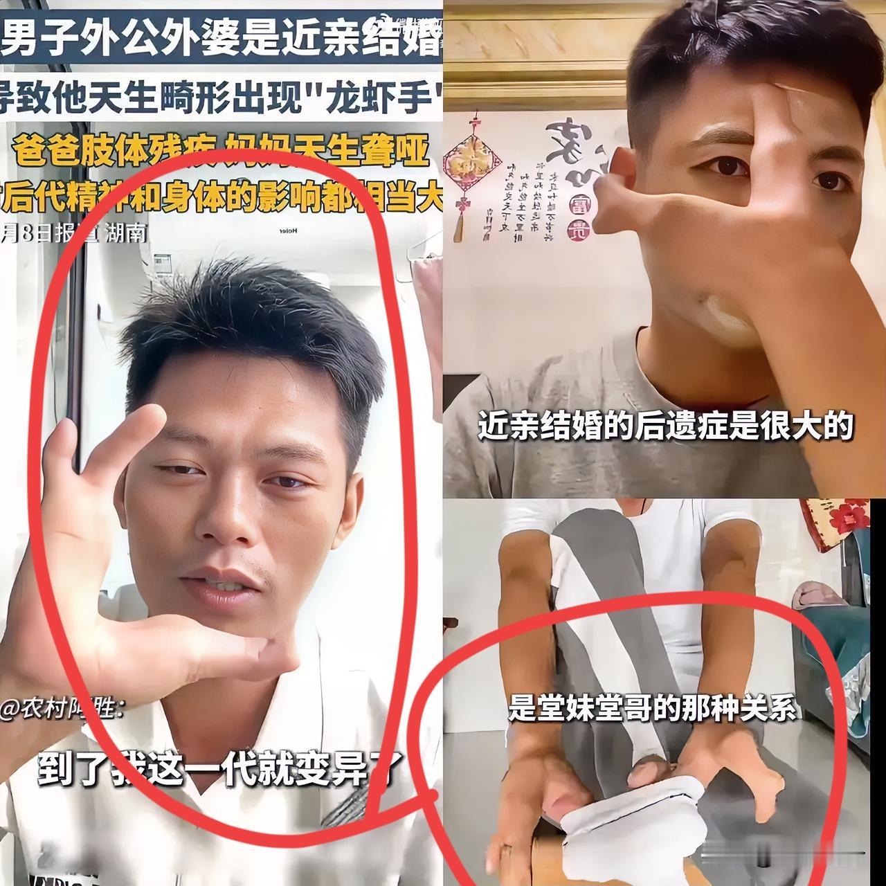 真的太离谱了！
湖南那户人家因近亲结婚，
三代人被健康问题拖垮，
这哪是传宗接代