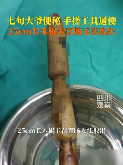 71岁大爷便秘用木棍疏通肠道 近日，据贺州广济医院消息，71岁大爷排便困难，用木