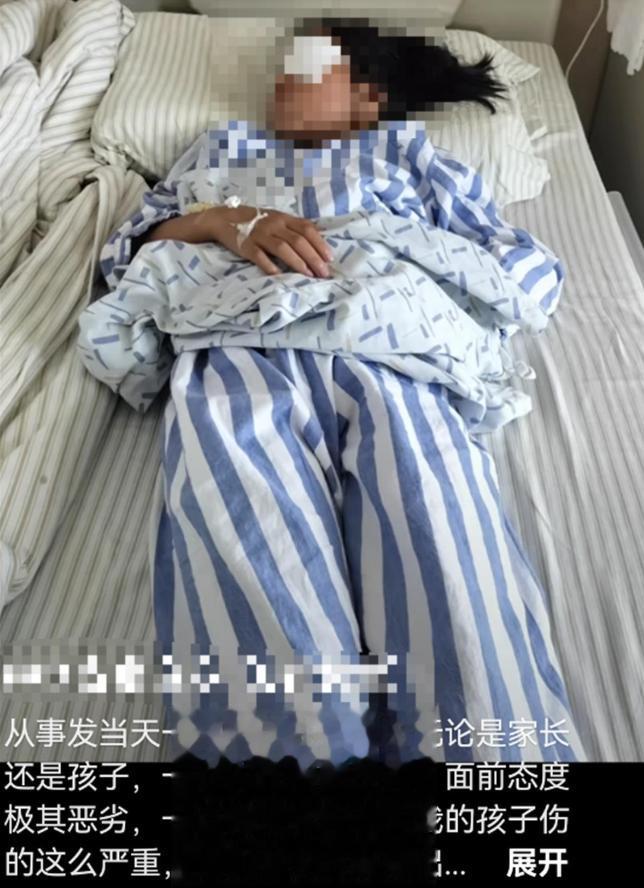 两少年射瞎8岁女童左眼逃离， 警方：未达刑责年龄，不予立案
该事件发生于江苏沭阳