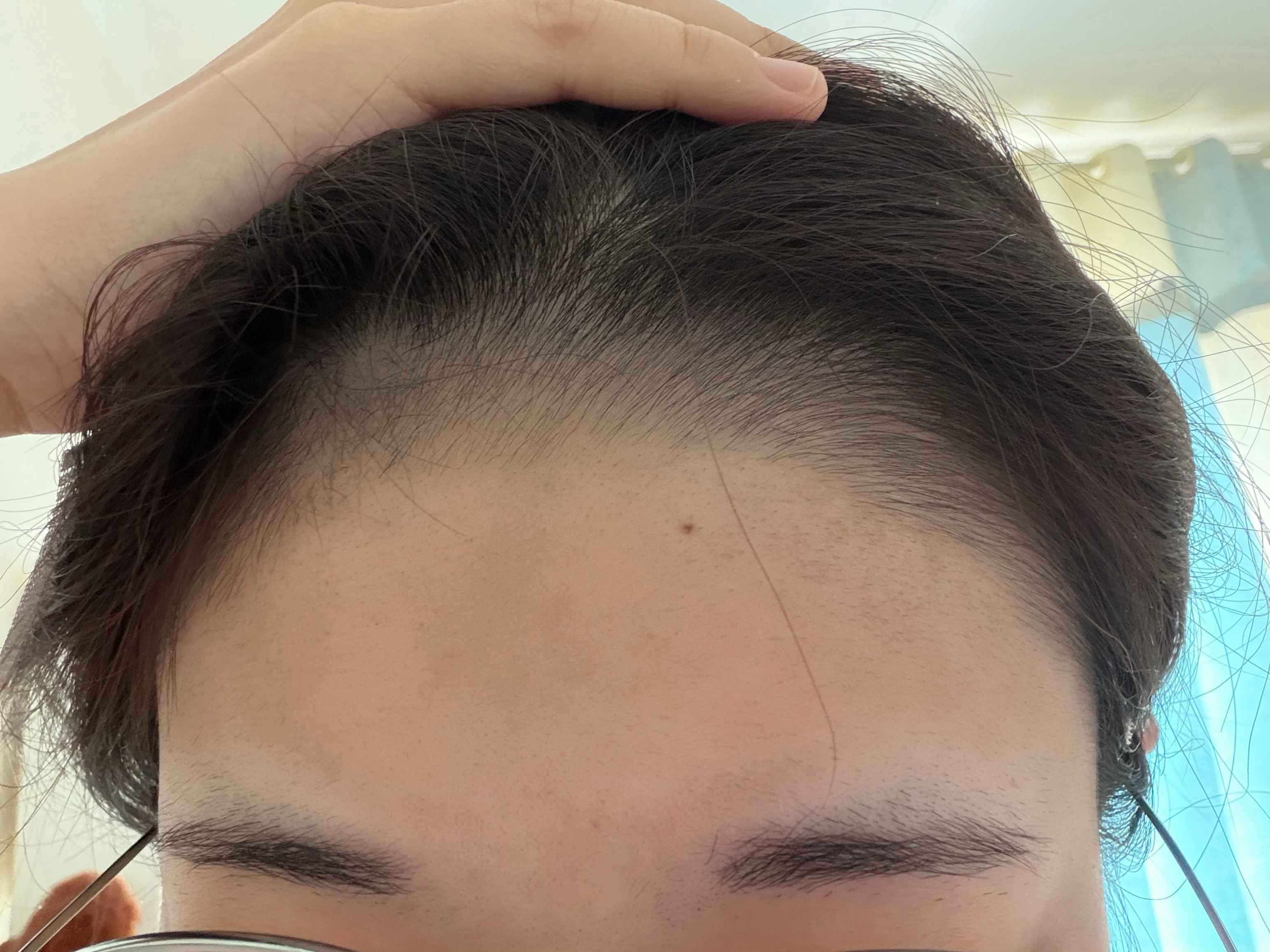 分享一下我的脑门儿嘎嘎嘎嘎 