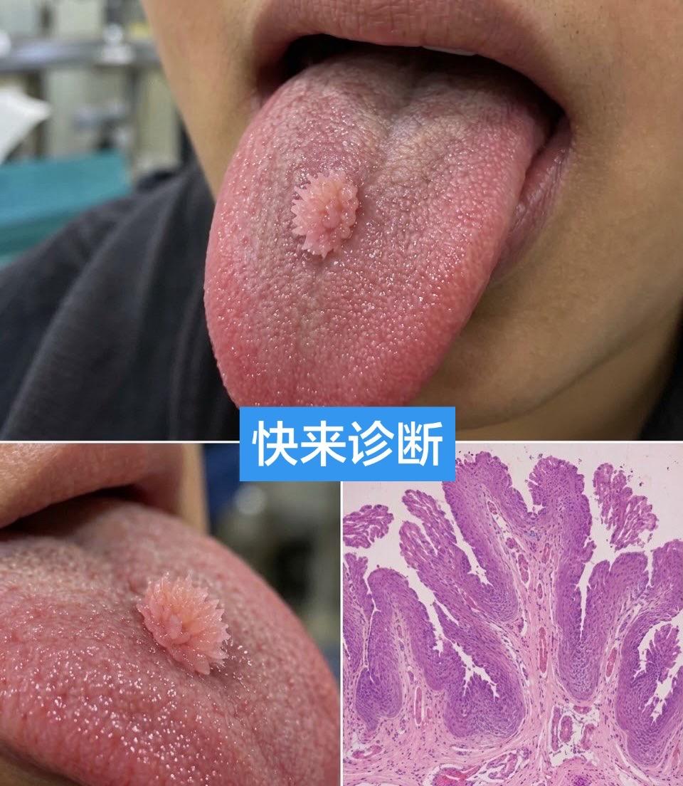 医学科普健康 健康知识科普