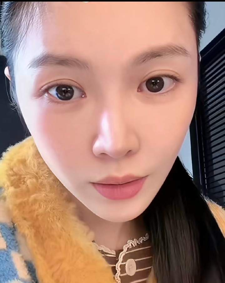 杜淳妻子因打耳洞做两次手术本想变美却遭罪！王灿打耳洞后疤痕增生复发，两次手术后耳