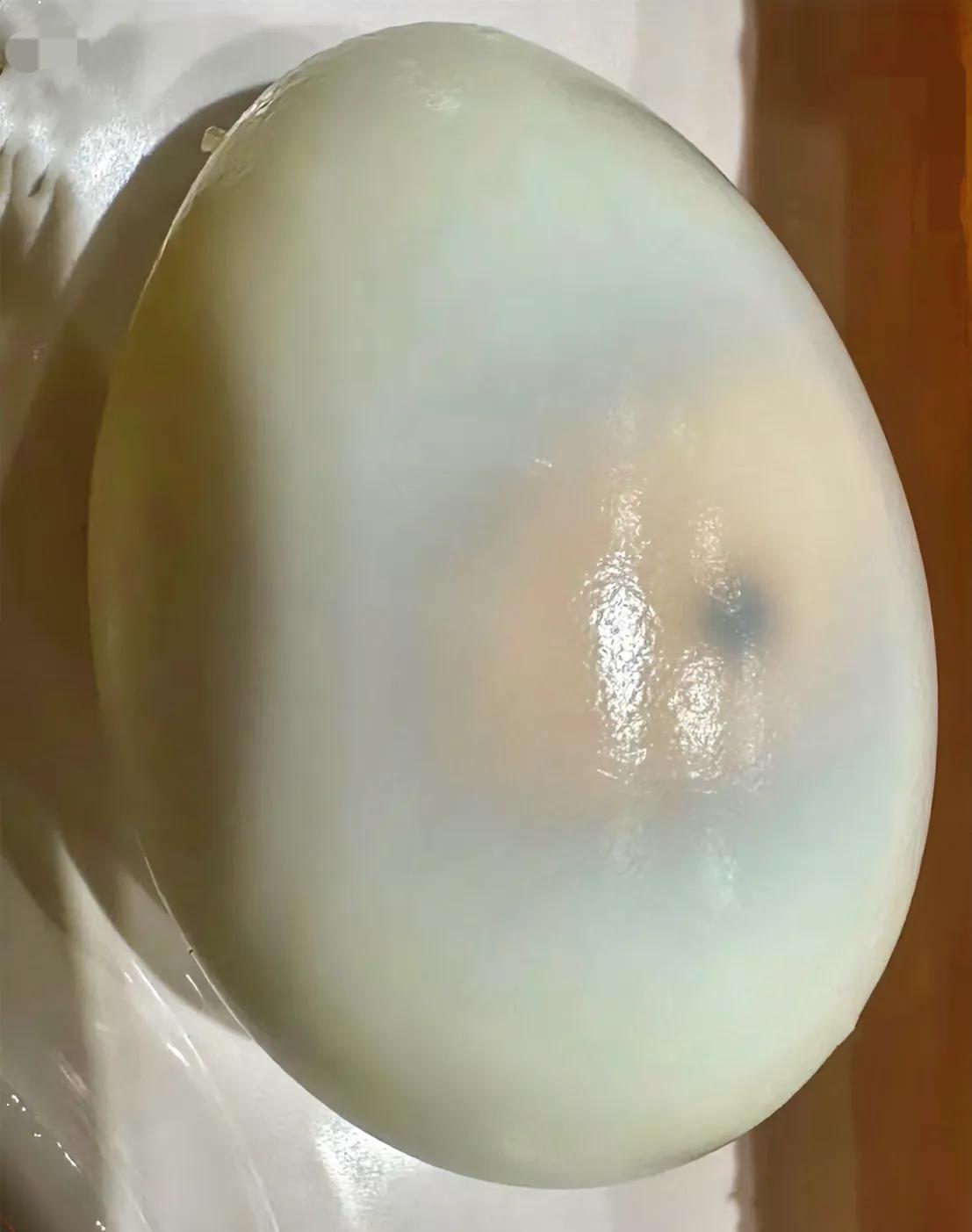 鸡蛋里的黑点是啥，不懂就问，这黑点它能吃掉吗  #热门#