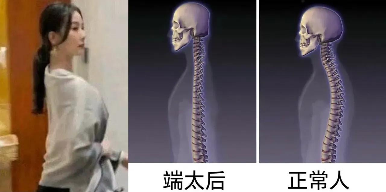 刘诗诗这仪态真的正常吗[what]