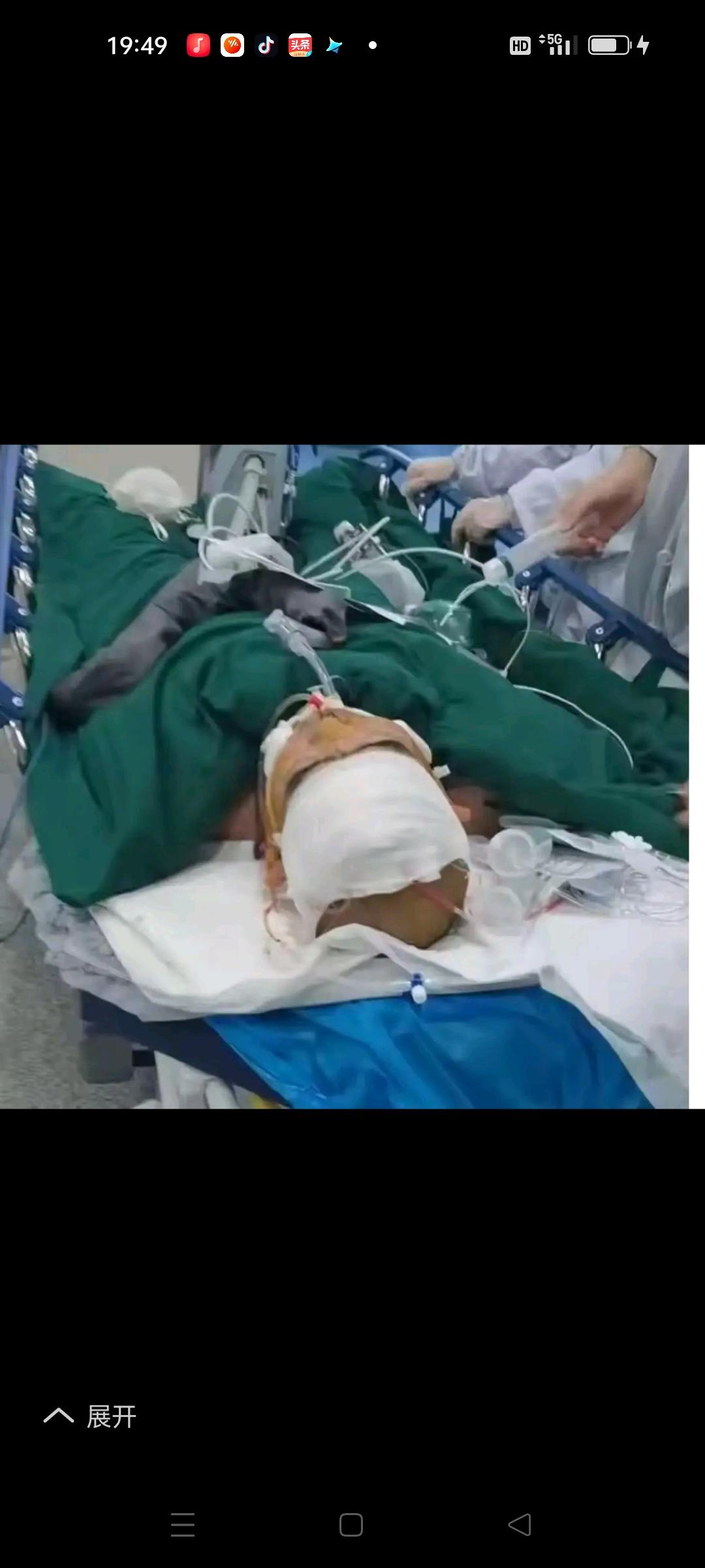 湖北十堰，公司食堂误把工业酒精icon当散酒，3个员工下班聚餐后一个抢救无效死亡