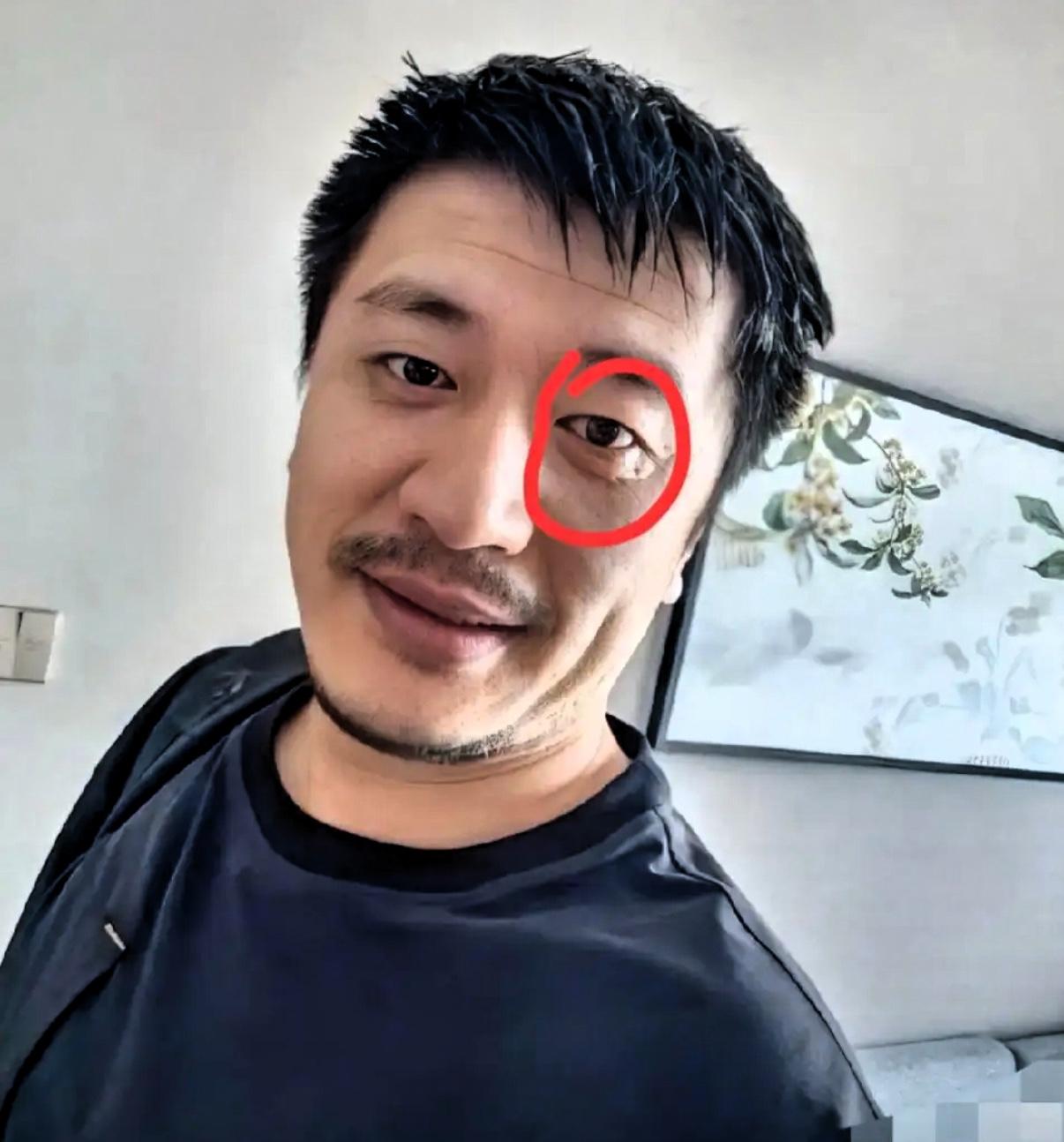 张雪峰身上还有个疑点，
想了一夜也没有想通，
就是他有专业的护理团队，按说这种事