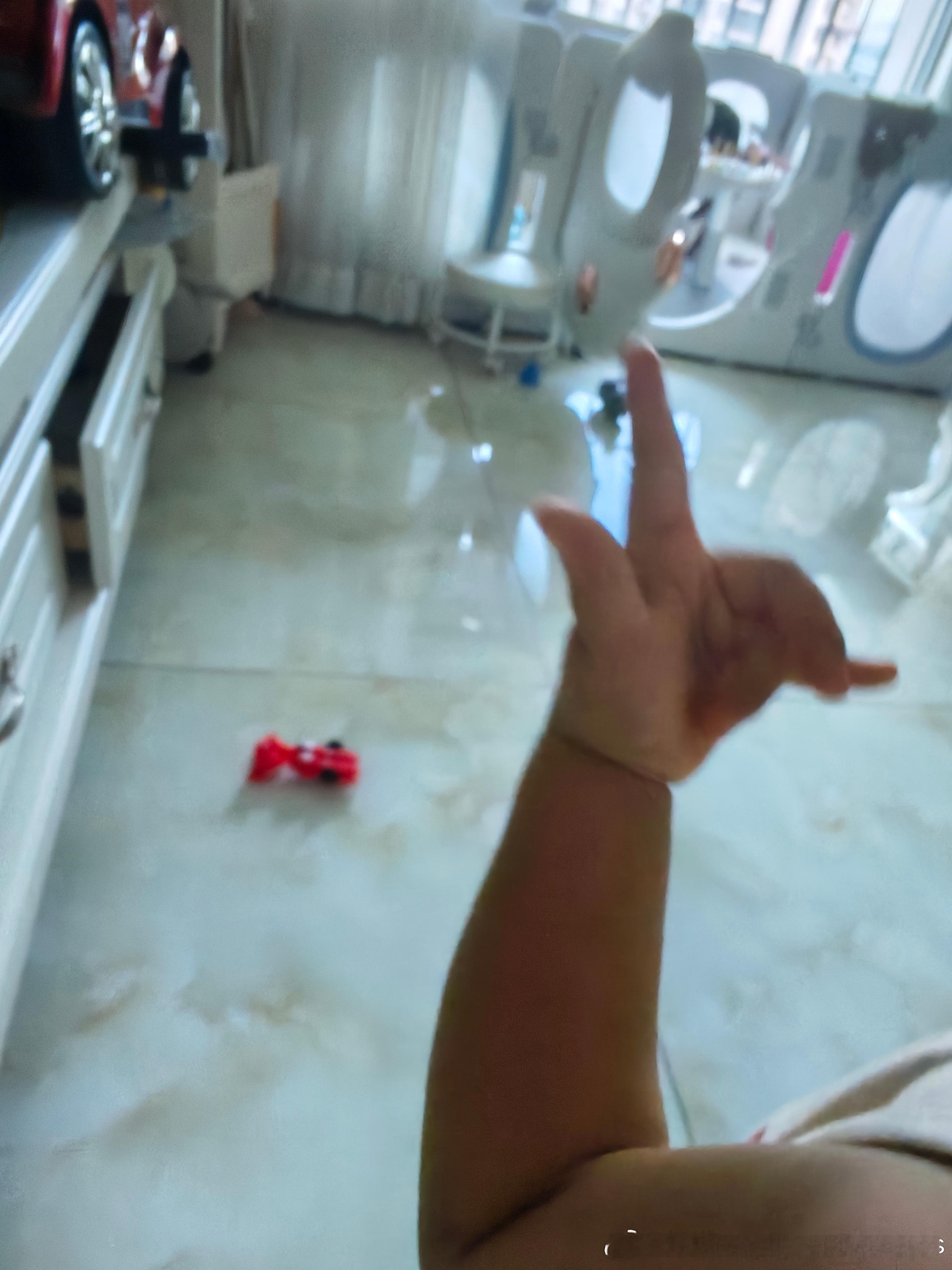 笑笑的手不是伤到了吗伤的是食指 当时没哭但给他处理时哇哇哭大人只要一说这个伤口就