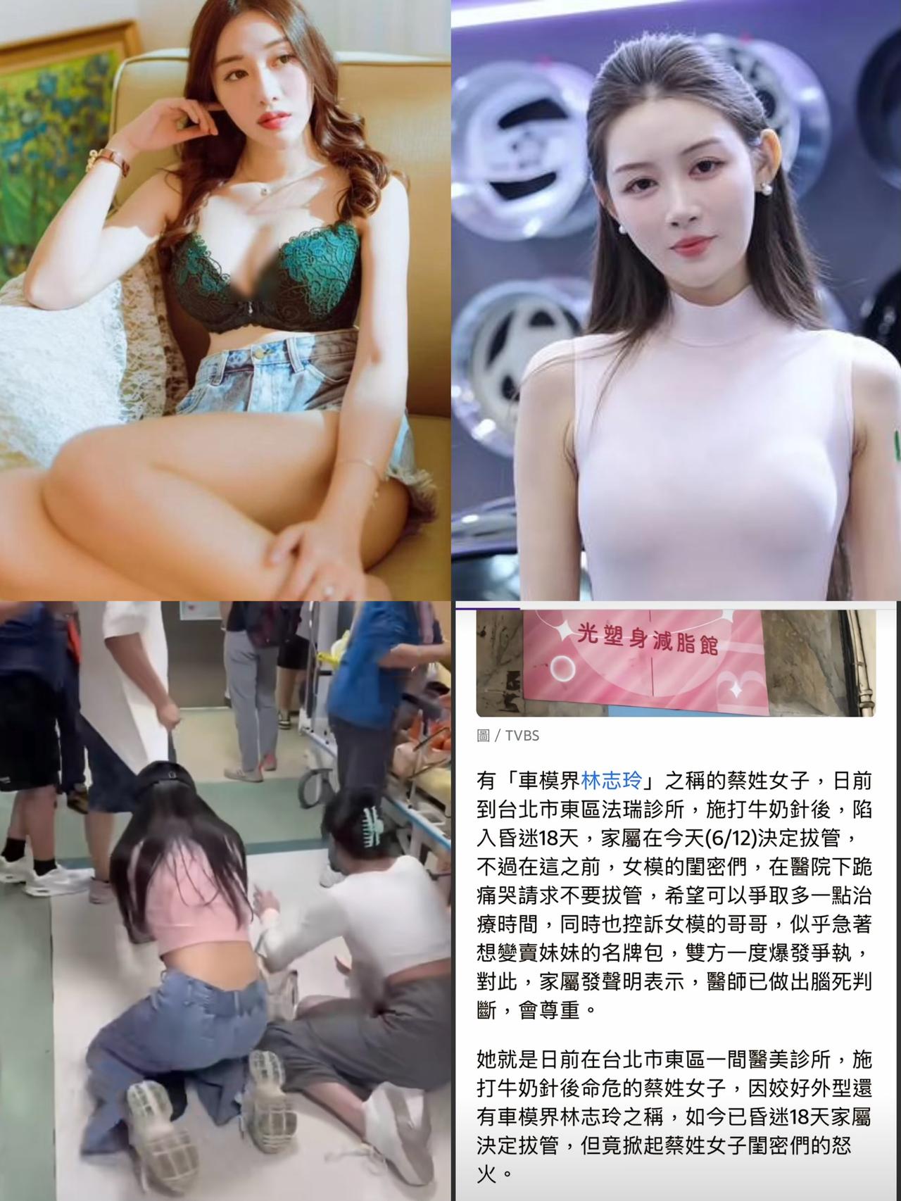 有“台湾车模界林志玲”之称的蔡语芯今天去世，年仅40岁，其因在一家诊所打牛奶针后