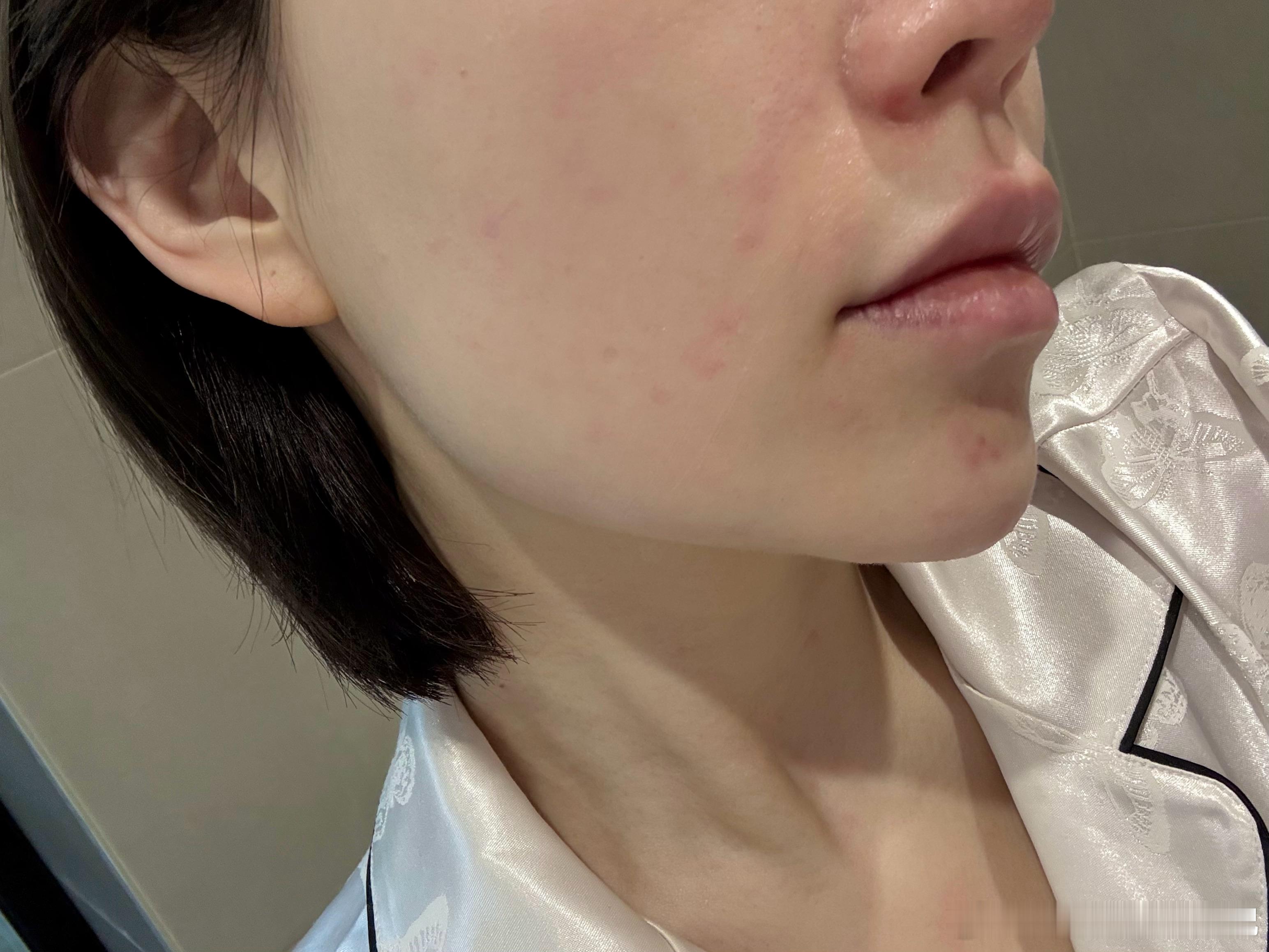 无语，特地买了个敏皮可用的洗面奶结果过敏了 