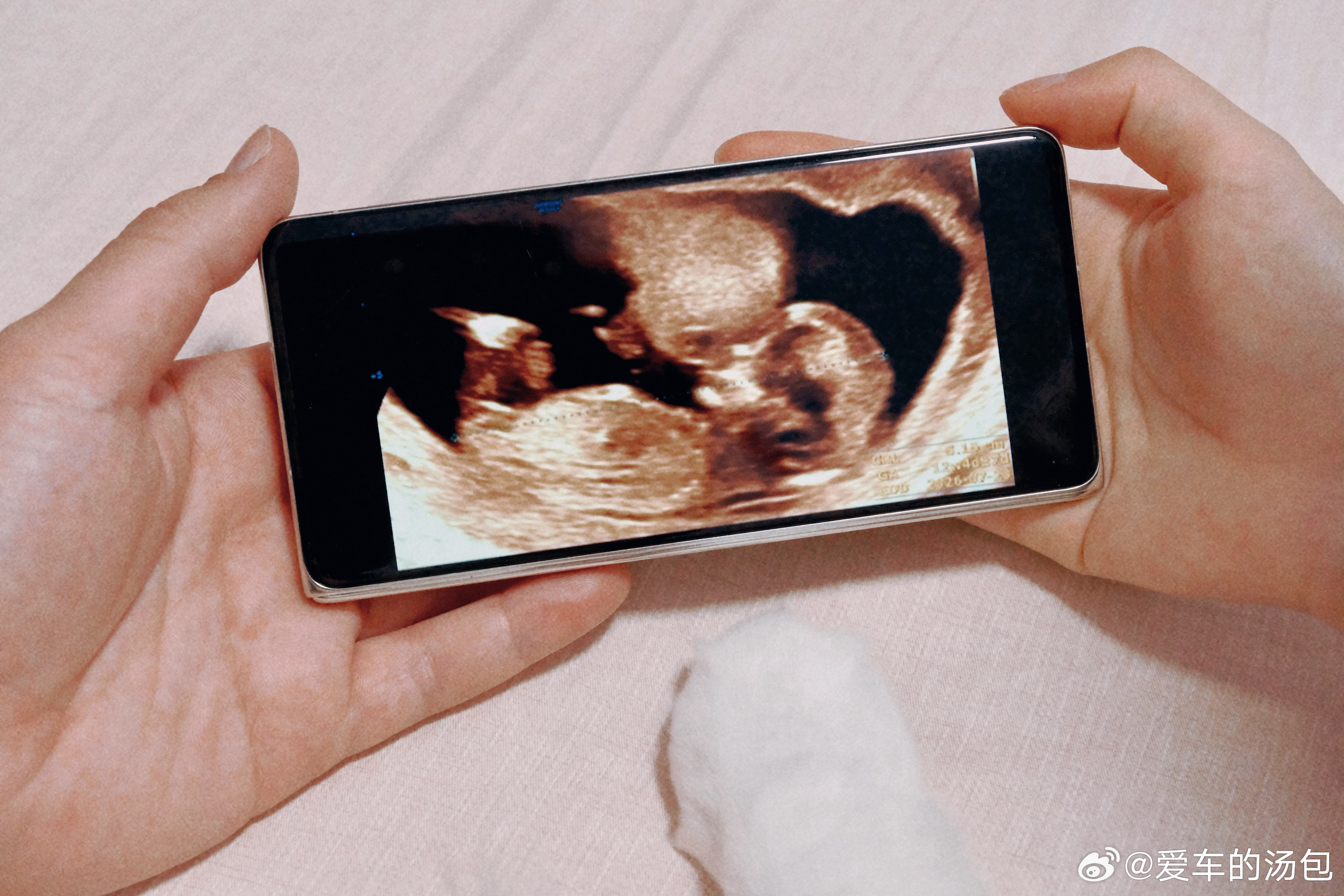 如果幸福是酵母，那我一定是蓬松的面包🥰会像谁呢～我鸿的恋爱日记