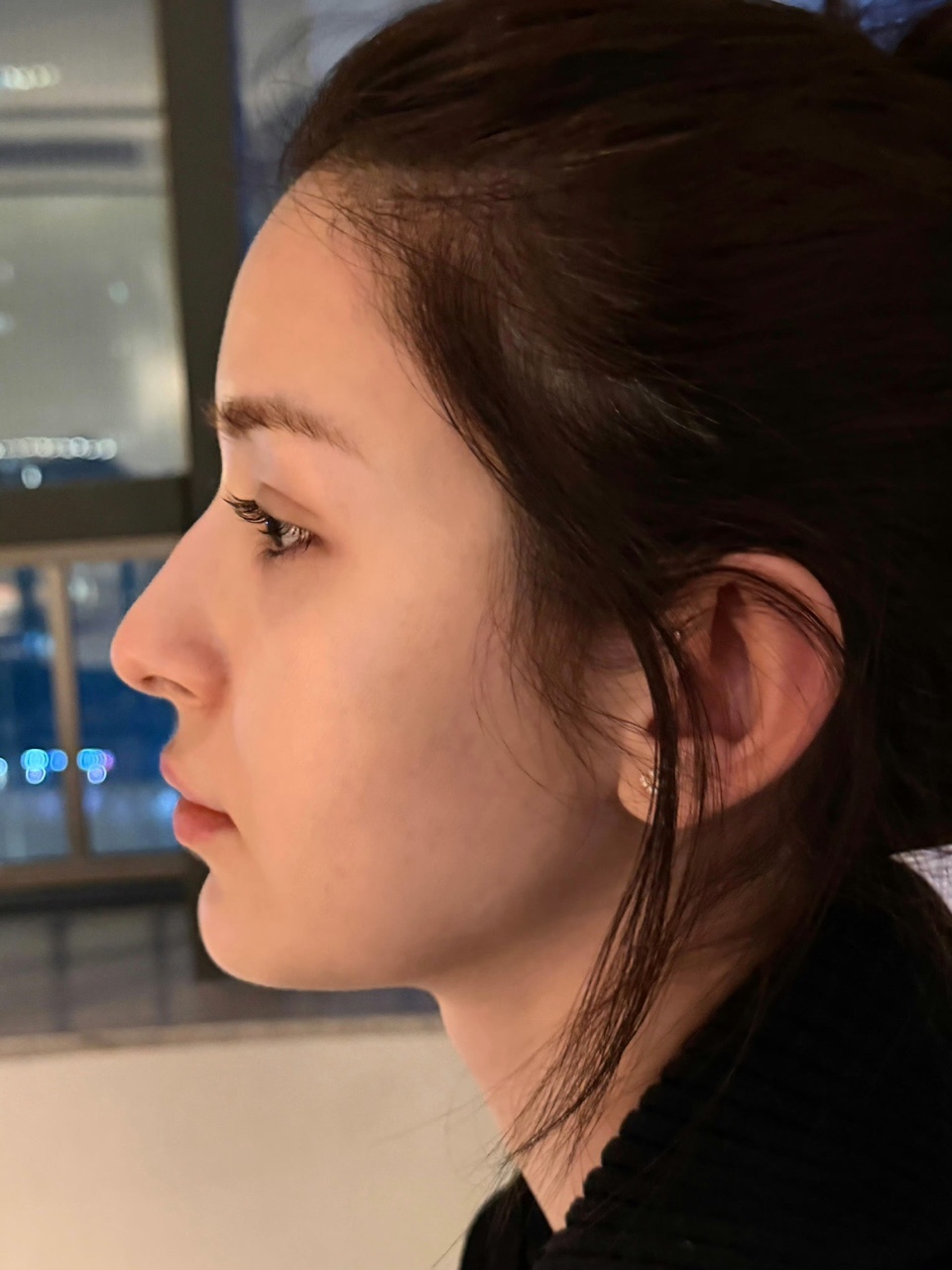 娱乐哈妮克孜拔阻生齿哈妮克孜求拔阻生齿的勇气 哈妮克孜拔阻生齿 