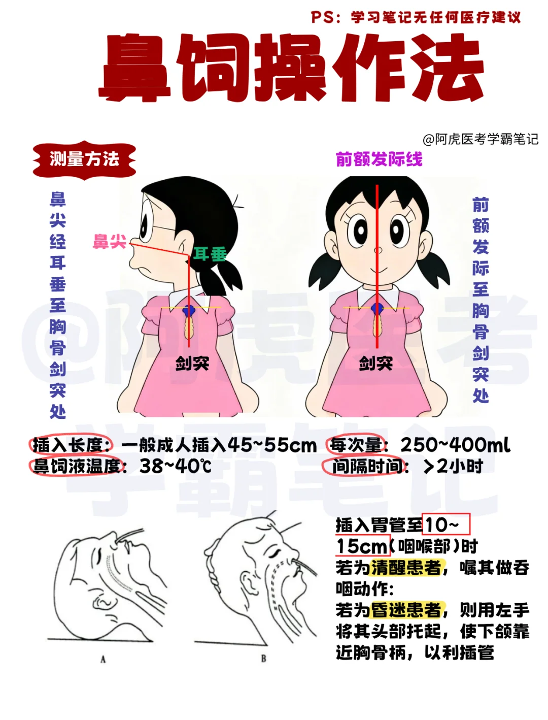 鼻饲的操作要点 🔥 谁还不会插胃管啊😱