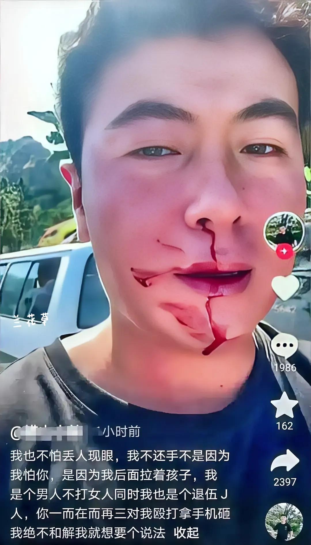青岛崂山逆行女车主暴打退役军人，那嚣张跋扈的样子，真是给女人丢脸。
看现场视频，