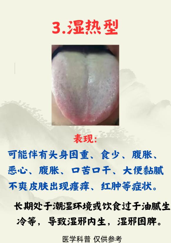 中医舌诊辨体质，轻松了解自身状况