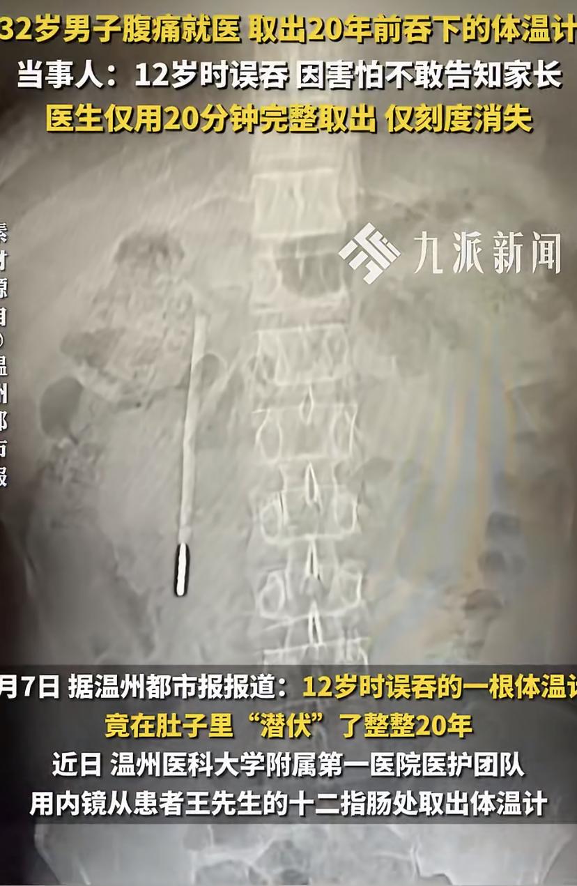 32岁的王先生最近肚子总不舒服，去温医大附一院龙港院区做了个腹部CT。结果把医生